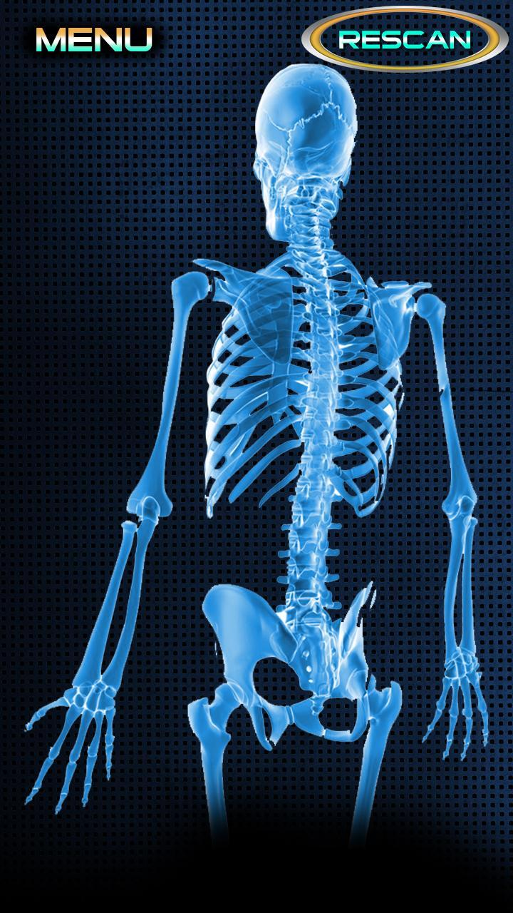 X-Ray Full Body Prank
