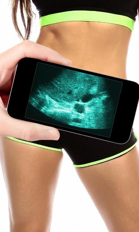 Ultra Sound Simulator : Prank